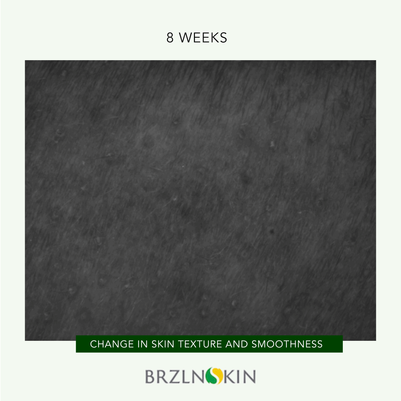 BRAZILIAN FACELIFT KIT 30% OFF with INTROSPECIAL Code