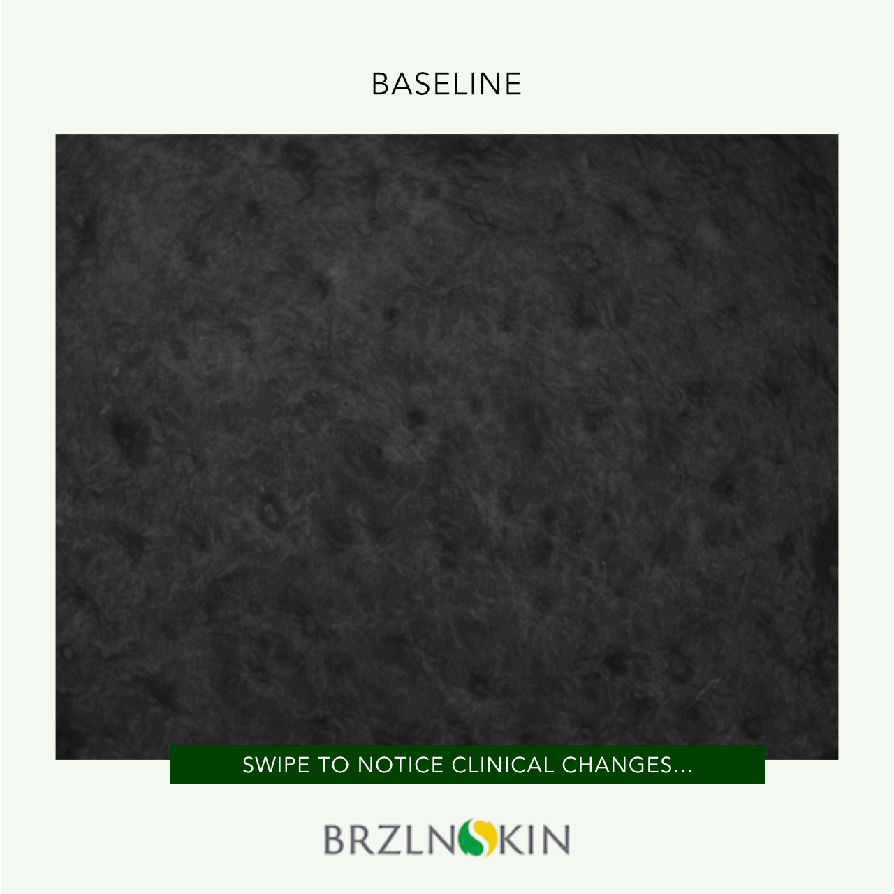 BRAZILIAN FACELIFT KIT - A clinically-tested revolutionary