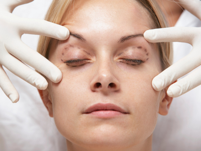 Removing Eye Bags with Surgery